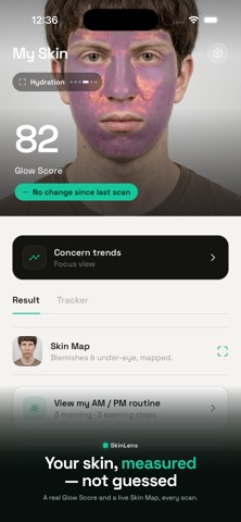 SkinLens: AI Skin Analysis screenshot