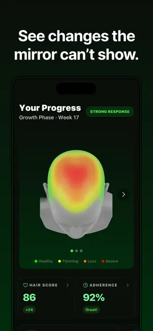 Hairmaxxr: Hair Growth Coach screenshot 4