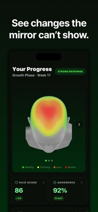 Hairmaxxr: Hair Growth Coach screenshot 4
