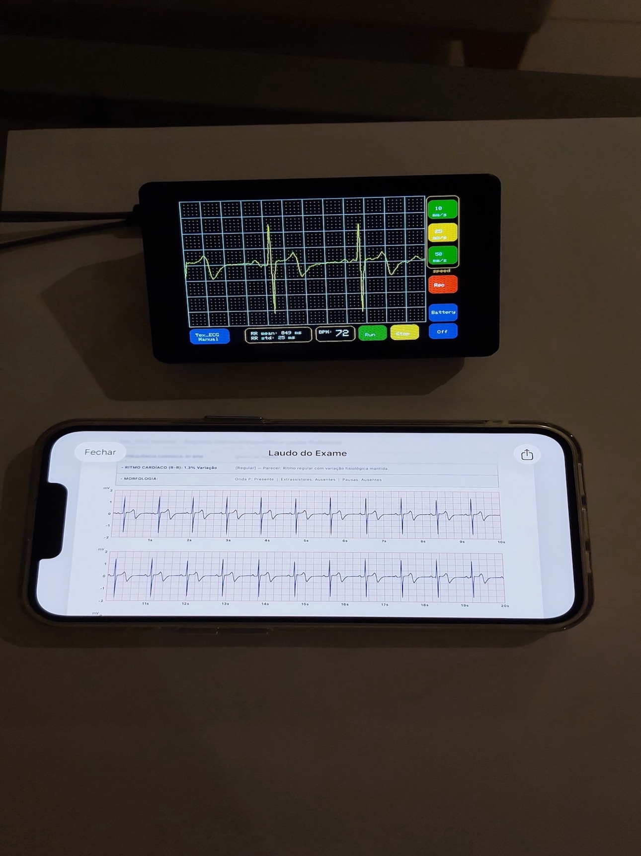 Screenshot 8 of TexECG