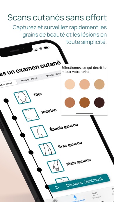 Screenshot #3 pour Skin-Check