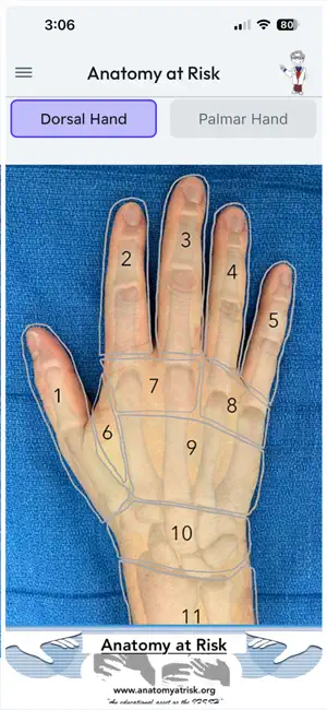 Anatomy at Risk screenshot 1