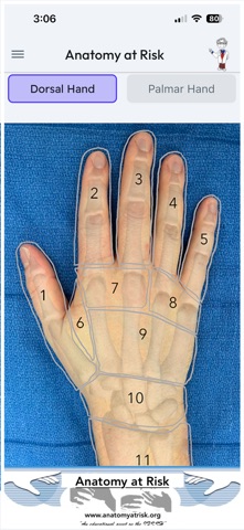 Anatomy at Risk screenshot