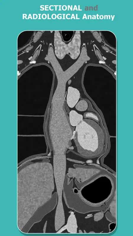 Anatomy Learning - 3D Atlas screenshot 3 of 7