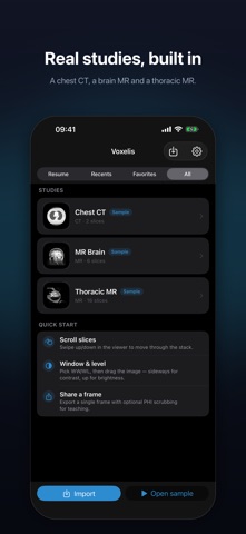 Voxelis: DICOM Viewer Screenshot 7 of 9