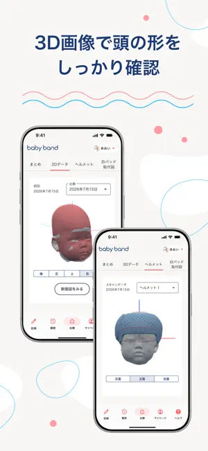 ヘルメット治療記録アプリ-babyband screenshot 4