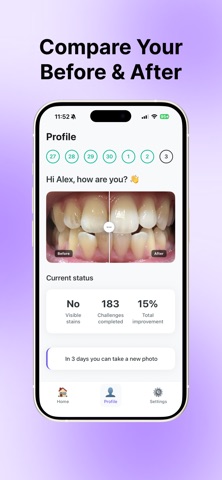 Blanq ai - Whiten Your Teeth screenshot
