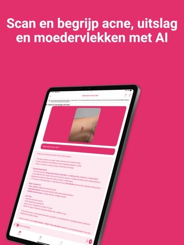 Derma AI: AI voor dermatologie iPad screenshot 3