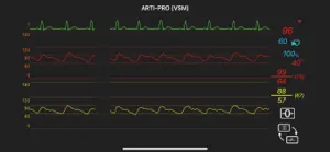 ARTI-PRO VSM screenshot 3