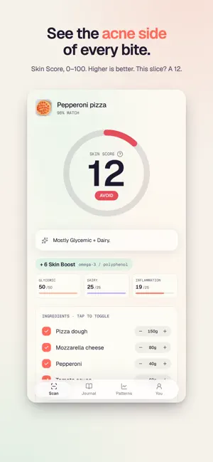 SpotBite: Acne Food Scanner screenshot 2