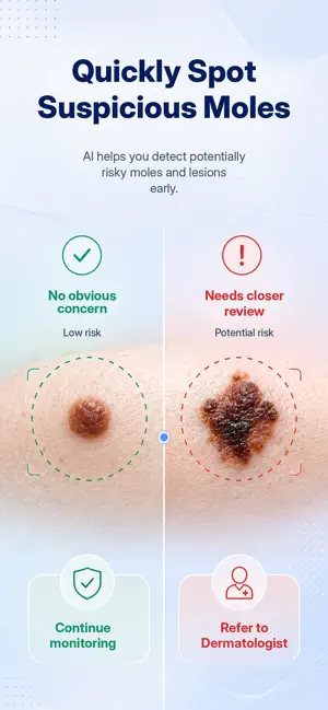 DermoScan: Skin Scanner screenshot 1