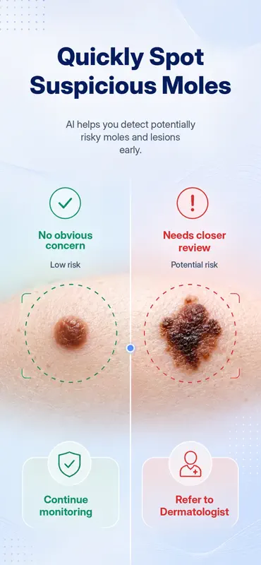 DermoScan: Skin Scanner screenshot 1 of 5