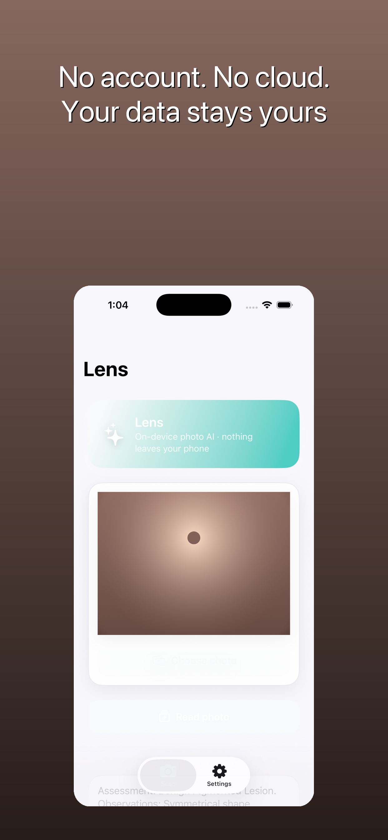 Lens: Private Skin & Mole AI screenshot 5