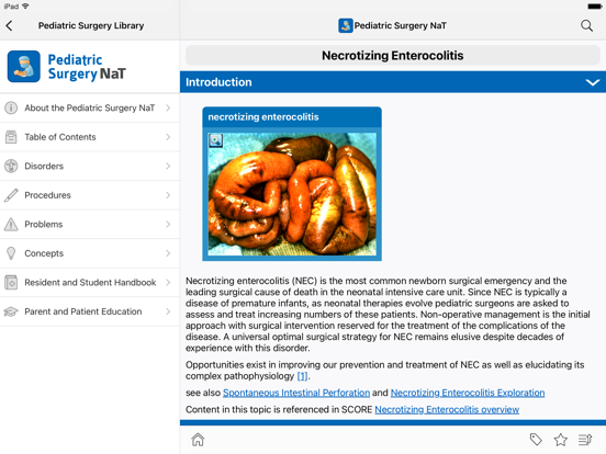 Screenshot #4 pour APSA Pediatric Surgery Library