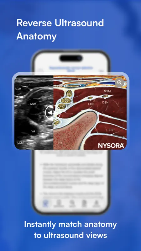 NYSORA Nerve Blocks screenshot 5 of 5