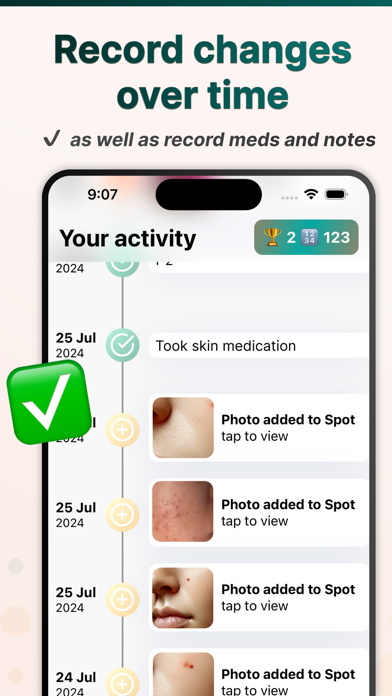 Spots: Moles Acne Skin Tracker Screenshot