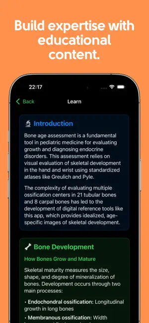 Easy Bone Age Atlas screenshot 3