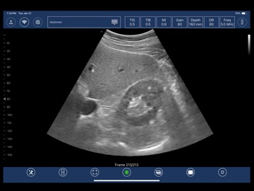 EdgeLife Screenshot 5