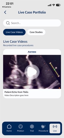 Anteris DurAVR Paradigm Trial iPhone screenshot