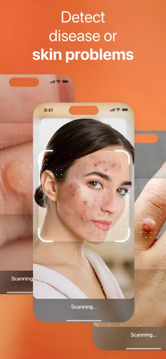 AI Skin Scanner: Screenshot 7 von 7