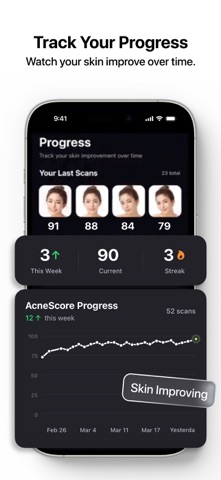 AcneScore | Identify Triggers Screenshot 9 of 10