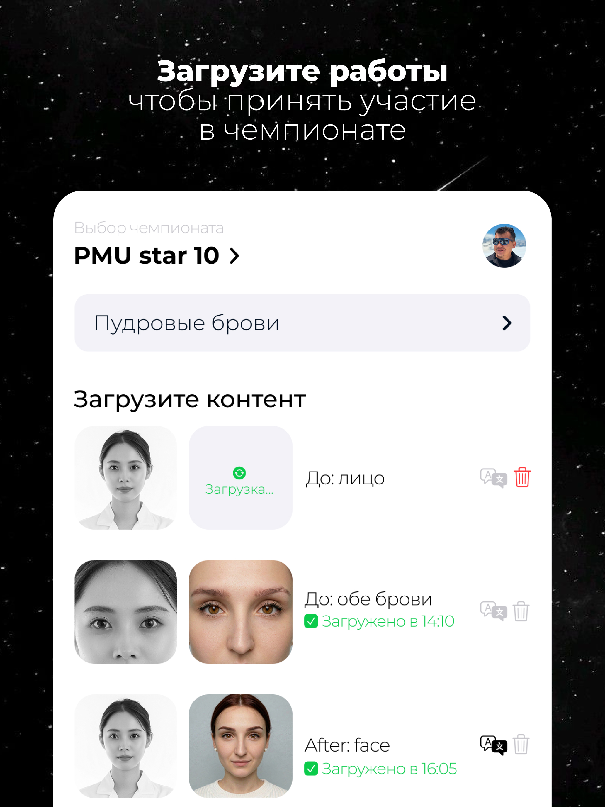 TOP LEVEL