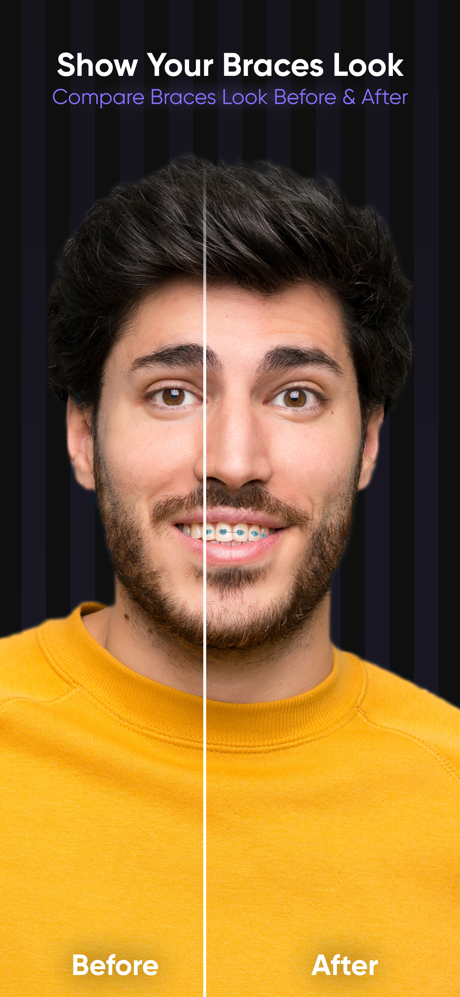AI Braces Camera Photo Editor screenshot 1
