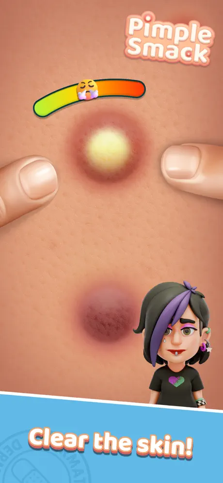 ASMR pimple popping simulator - satisfying skin care game