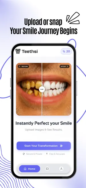 Teethsi | AI Veneer Try On screenshot 2