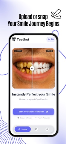 Teethsi | AI Veneer Try On Screenshot 2 of 5