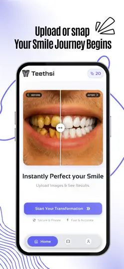 Captura de pantalla de Teethsi | AI Veneer Try On en iPhone 2