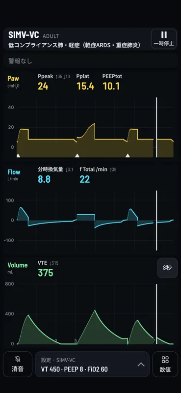Vent Sim - Ventilator Training screenshot 1 of 6