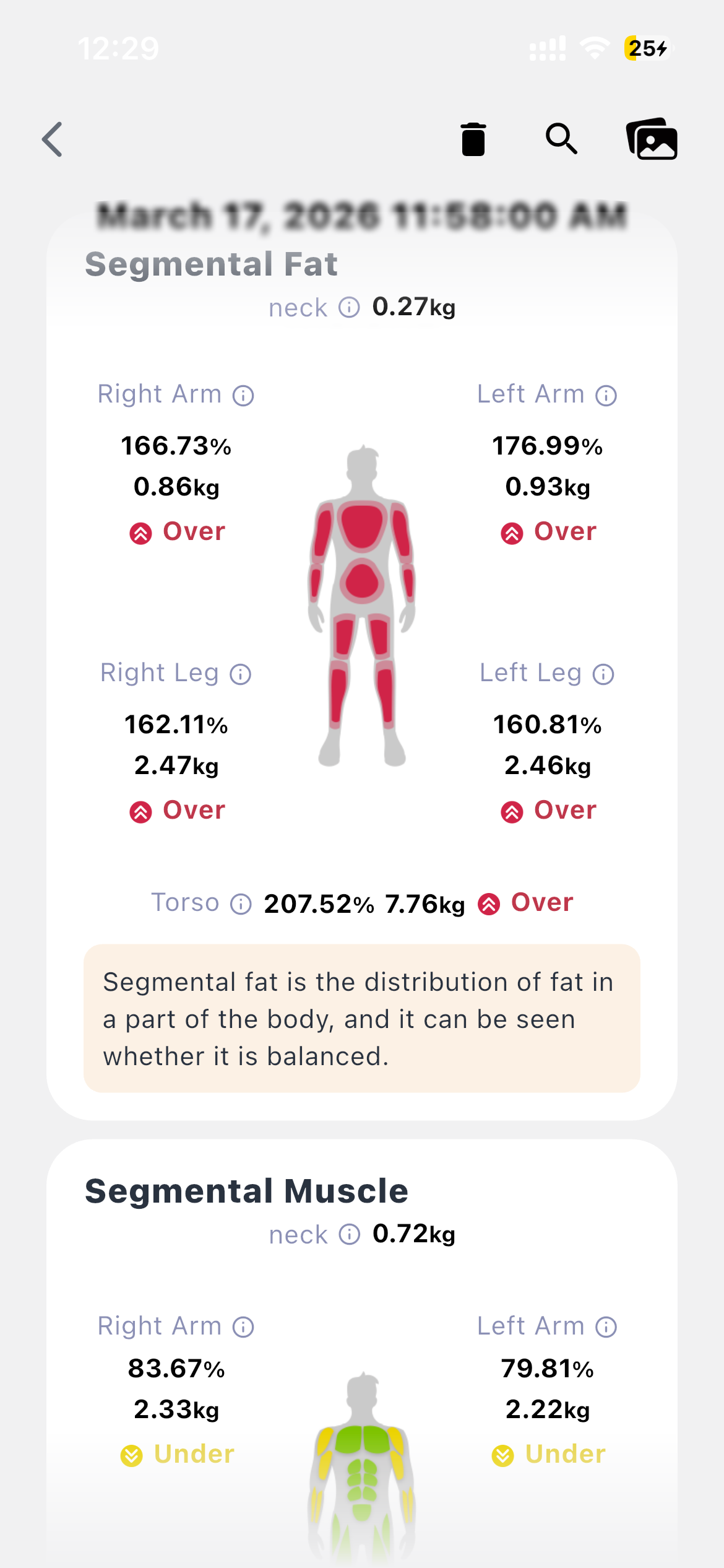 BodyInsight