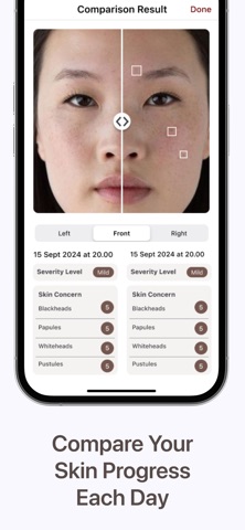 Skinalyze Screenshot 5 of 5