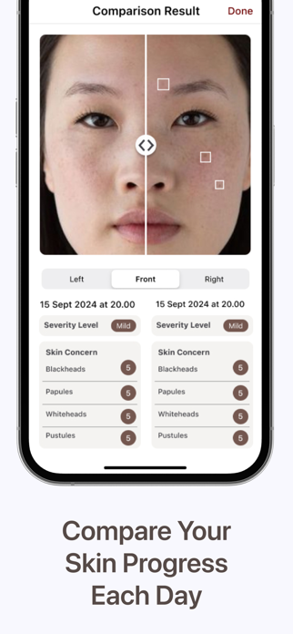 Skinalyze Screenshot 5 of 5