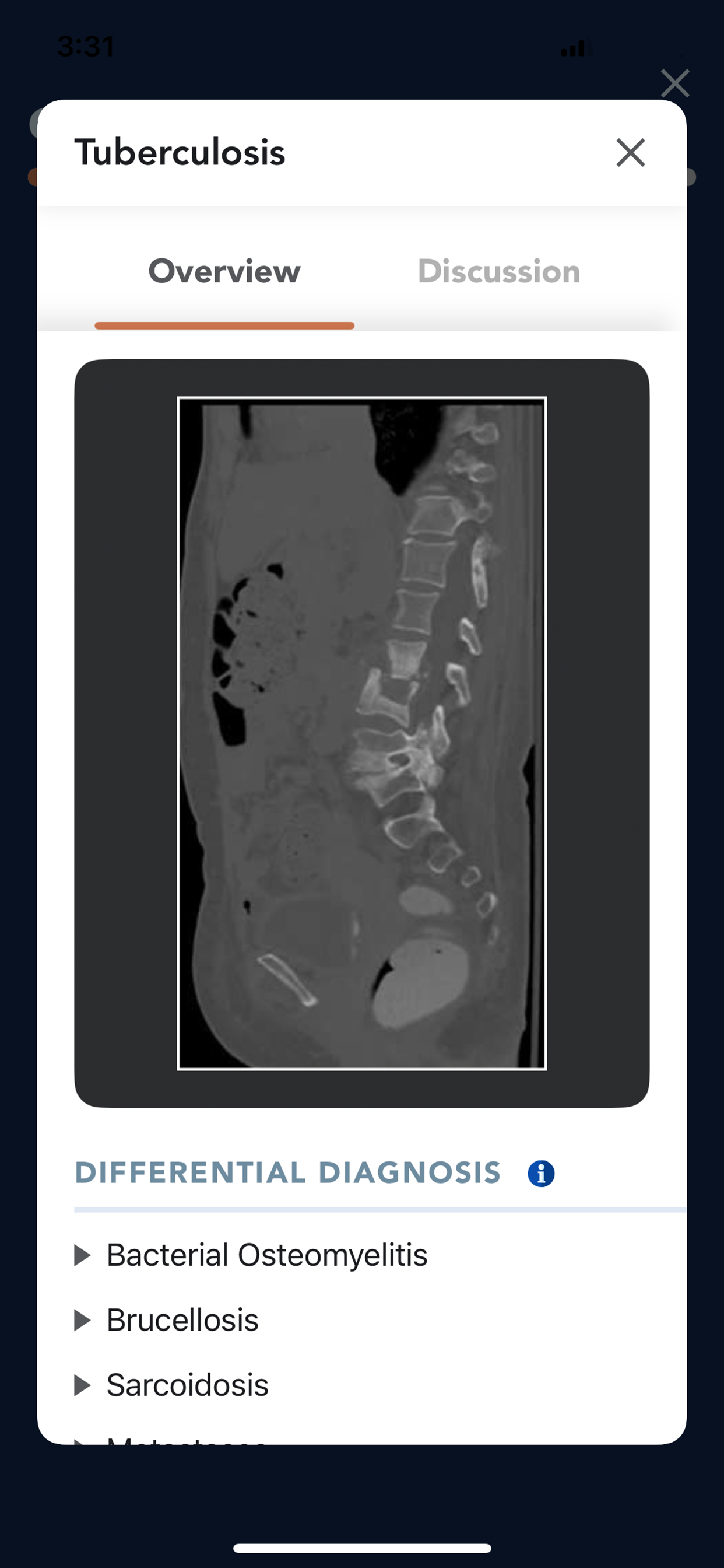 CTisus L-Spine Pathology