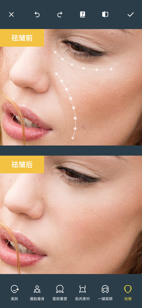 Photo Retouch:消除笔及p图修图软件,神奇橡皮擦 screenshot 6