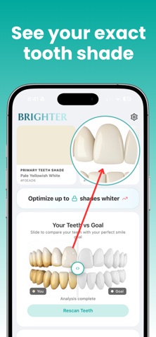 Brighter: get whiter teeth screenshot