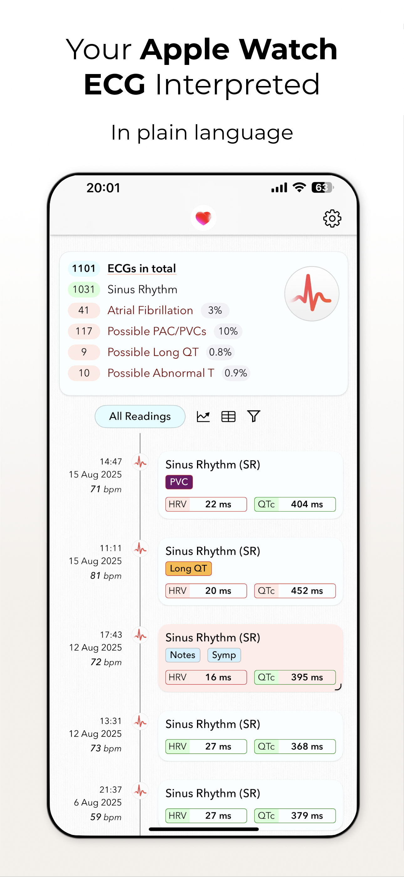 ECG+ | Your Watch ECG Reader