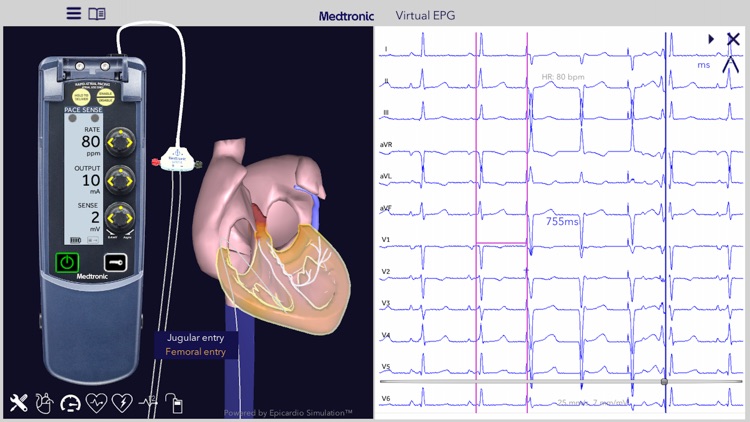 Medtronic VirtualEPG screenshot-4