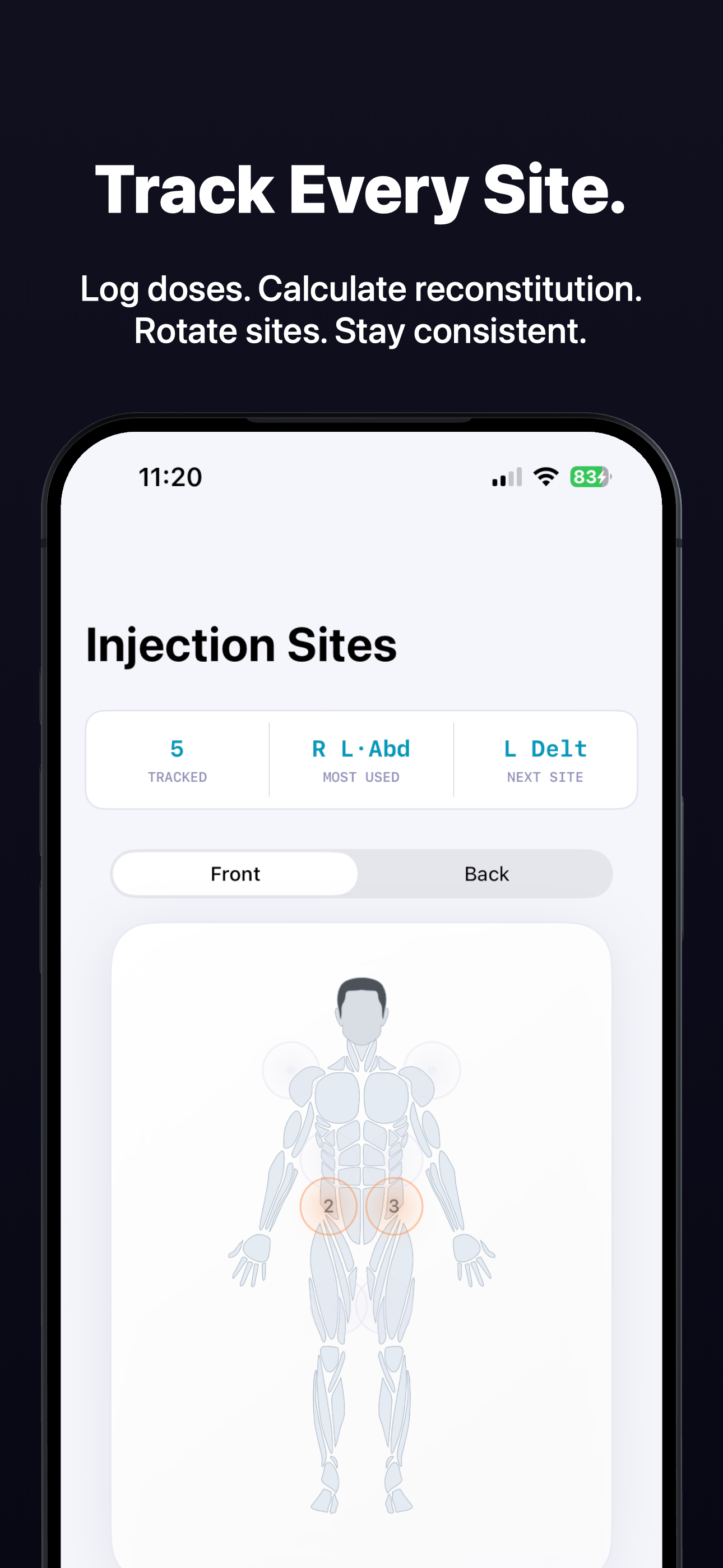 Tracktide - Injection Tracker