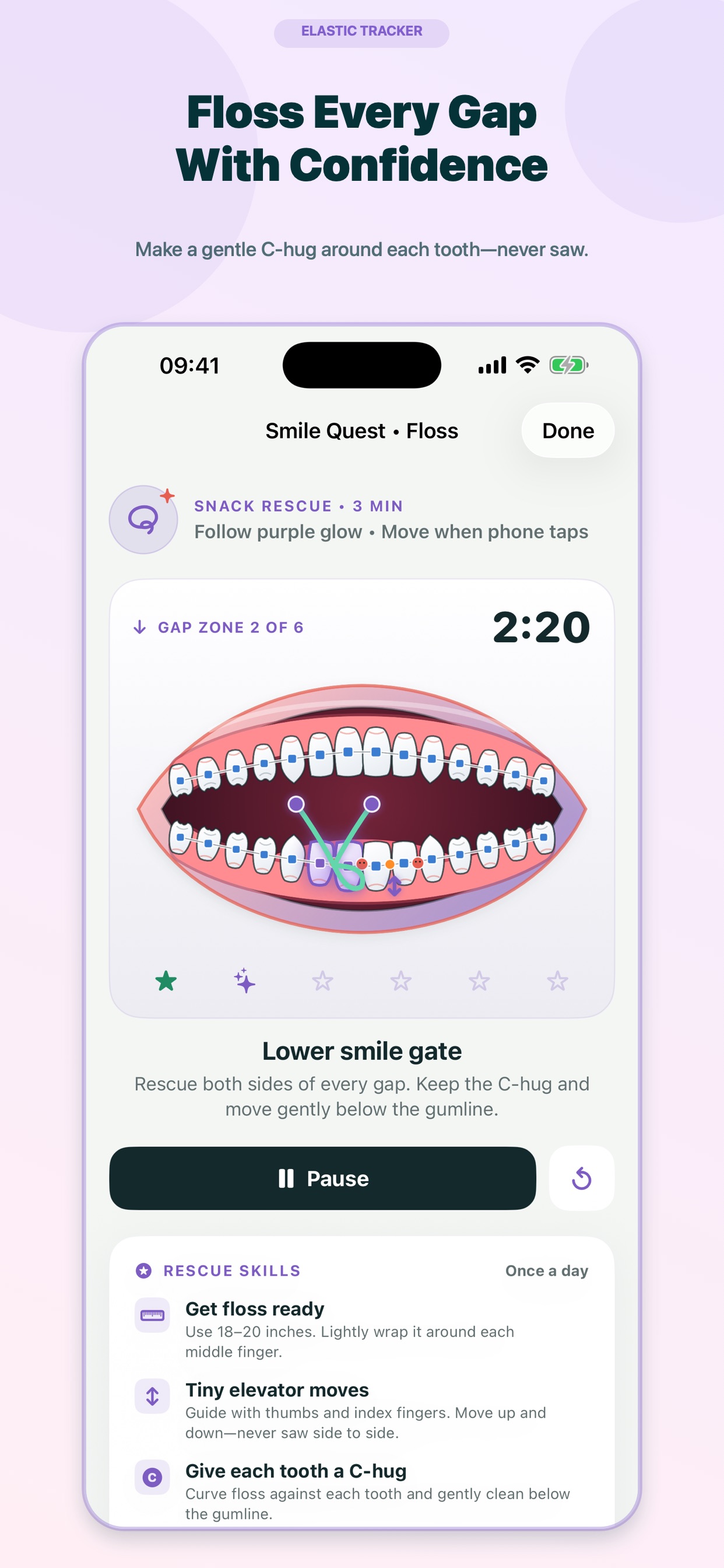 Screenshot 4 of Braces Rubber Band Tracker
