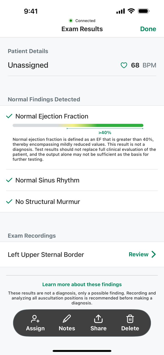SENSORA™ by Eko Health