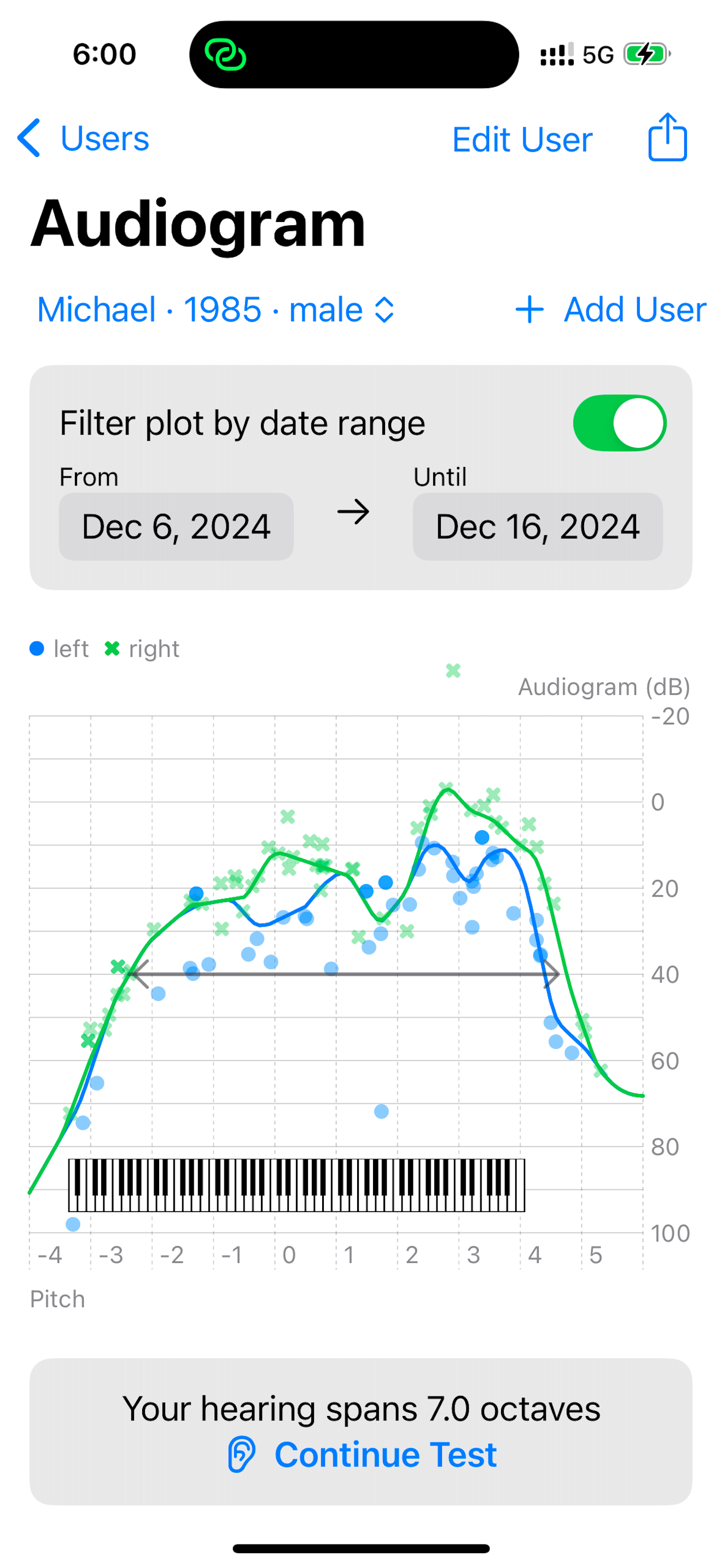ListenUp Hearing Test