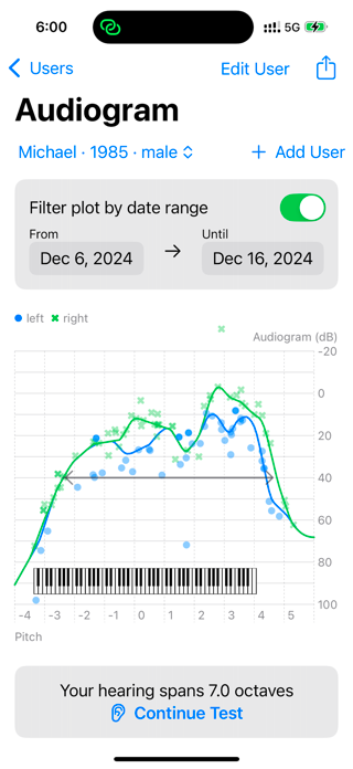 ListenUp Hearing Test Screenshot 1 of 9