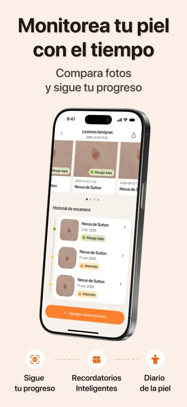 IA Escaner Piel: Salud UV+SPF screenshot 6 of 9
