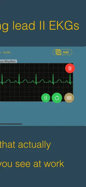 arrhythmia screenshot 2