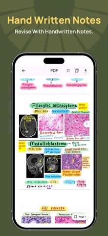 Clavicle Screenshot 8 of 8