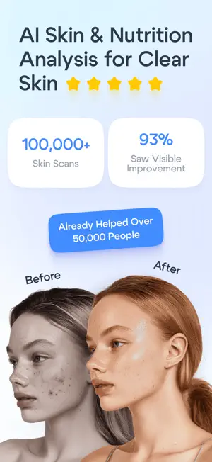 Lumé: Skin Scanner screenshot 1