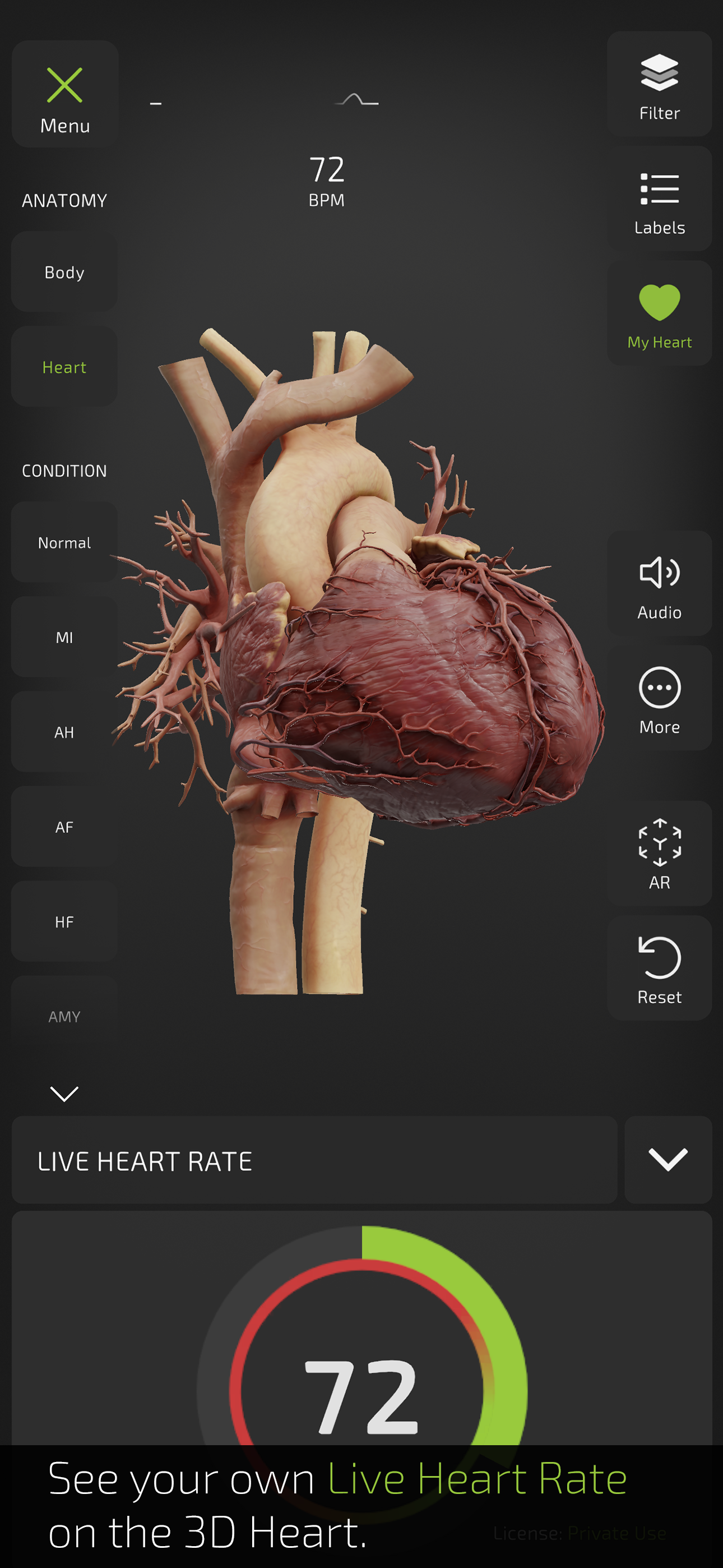 INSIGHT HEART